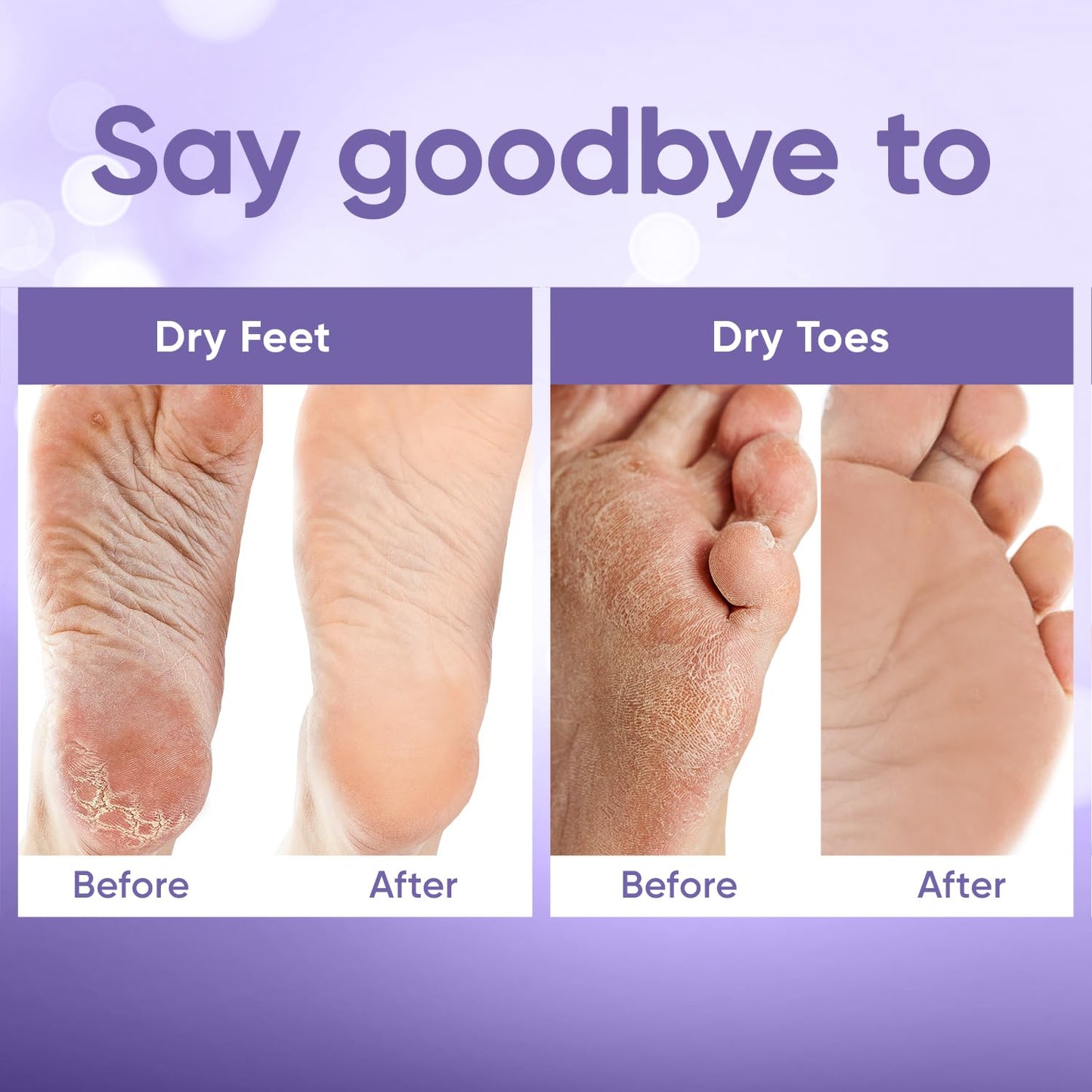 Exfoliating Foot Mask || Pedicure At Home