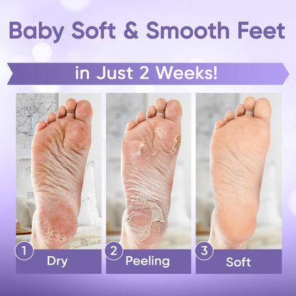 Exfoliating Foot Mask || Pedicure At Home