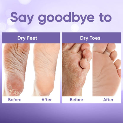 Exfoliating Foot Mask || Pedicure At Home
